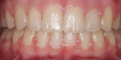 Before & Afters Before & Afters